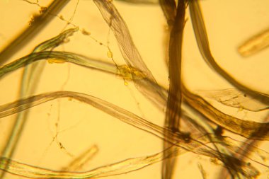 Toz mikroskobik görünümü