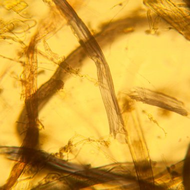 Toz mikroskobik görünümü