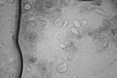 Canlılar arasında köhne su çürümüş bitki örtüsü ile mikroskobik görünümü. Terliksi hayvan caudatum 