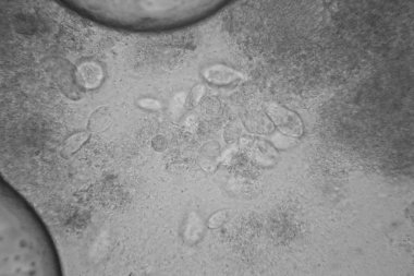 Canlılar arasında köhne su çürümüş bitki örtüsü ile mikroskobik görünümü. Terliksi hayvan caudatum 