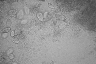 Canlılar arasında köhne su çürümüş bitki örtüsü ile mikroskobik görünümü. Terliksi hayvan caudatum 