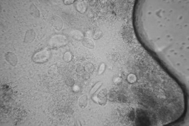 Canlılar arasında köhne su çürümüş bitki örtüsü ile mikroskobik görünümü. Terliksi hayvan caudatum 