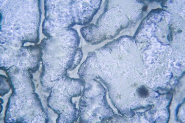 Kirli su kurutma mikroskobik görünümü 