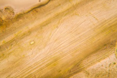 Mikroskop, çürümüş yaprak