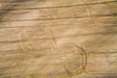 Mikroskop, çürümüş yaprak