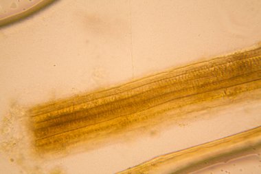 Mikroskop, çürümüş yaprak