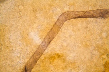 Mikroskop, çürümüş yaprak