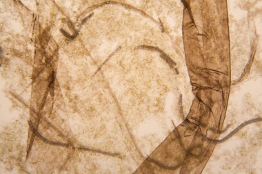 Mikroskobik görünümü ve çürük Lale kök detaylarını