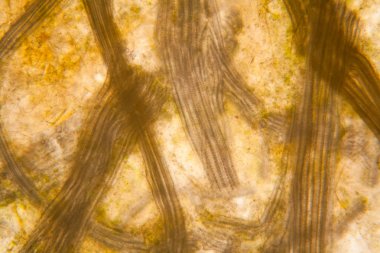 Mikroskobik görünümü ve çürük Lale kök detaylarını