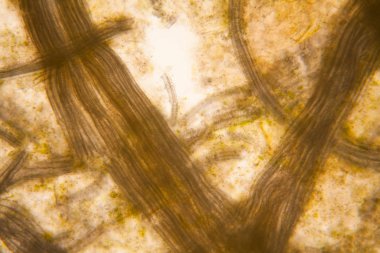 Mikroskobik görünümü ve çürük Lale kök detaylarını