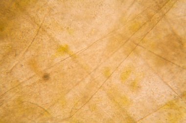 Mikroskobik görünümü ve çürük Lale kök detaylarını