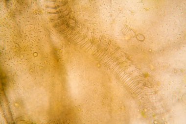 Mikroskobik görünümü ve çürük Lale kök detaylarını