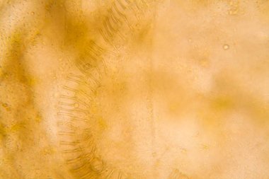 Mikroskobik görünümü ve çürük Lale kök detaylarını