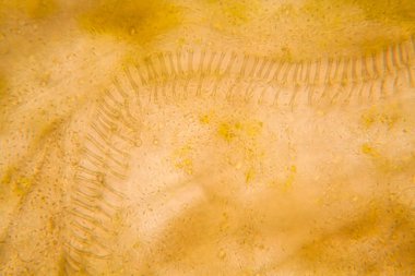 Mikroskobik görünümü ve çürük Lale kök detaylarını