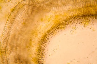 Mikroskobik görünümü ve çürük Lale kök detaylarını