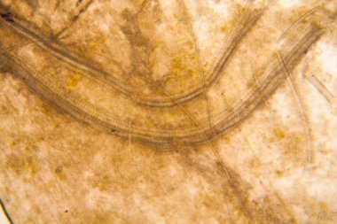 Mikroskobik görünümü ve çürük Lale kök detaylarını