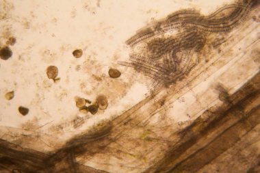 Mikroskobik görünümü ve çürük Lale kök detaylarını