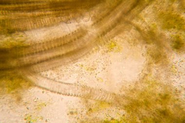 Mikroskobik görünümü ve çürük Lale kök detaylarını