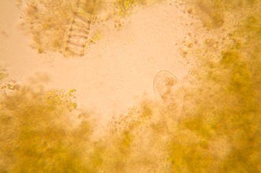 Mikroskobik görünümü ve çürük Lale kök detaylarını