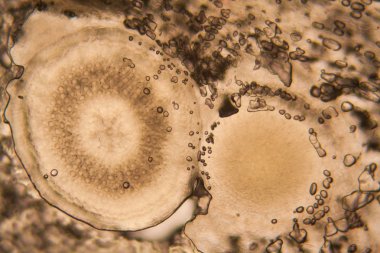 soğan kök hücreleri mikroskop