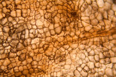 Havuç hücreleri mikroskop