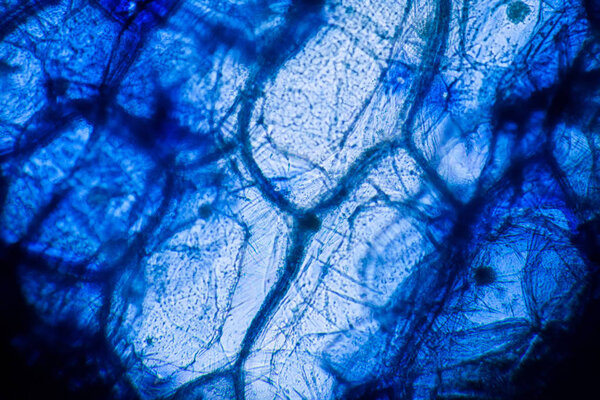 Onion cells at the microscope