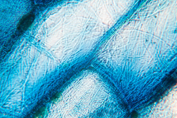 Onion cells at the microscope