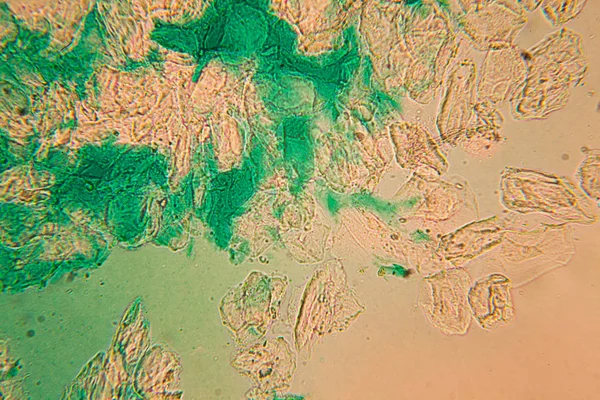 人体细胞和干燥的彩色水在显微镜下 — 图库照片