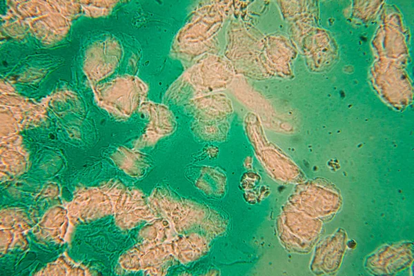 Sel Manusia Dan Air Berwarna Warni Kering Pada Mikroskop — Stok Foto