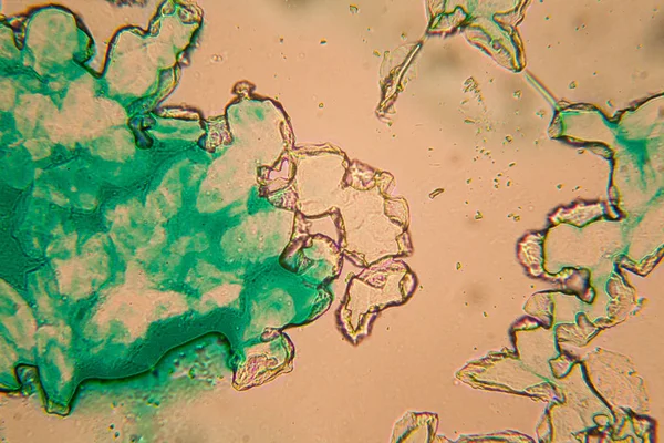 Menschliche Zellen Und Getrocknetes Buntes Wasser Mikroskop — Stockfoto