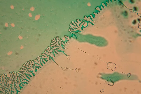 Menselijke Cellen Gedroogde Kleurrijke Water Bij Microscoop — Stockfoto
