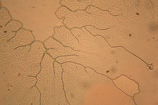 Людські Клітини Сушена Барвиста Вода Мікроскопі — стокове фото