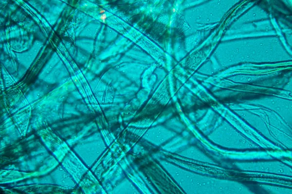 Toz mikroskobik görünümü