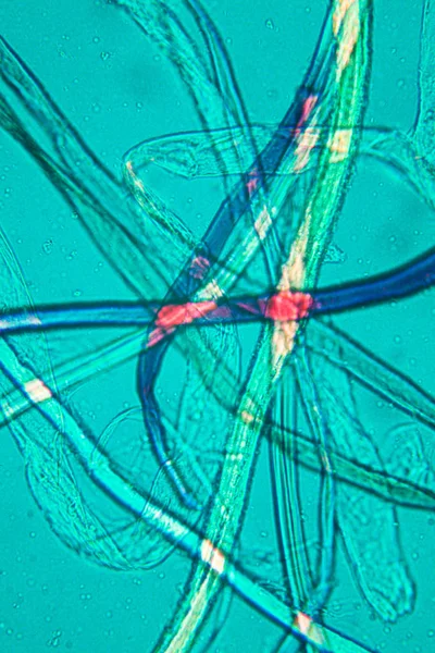 Toz mikroskobik görünümü