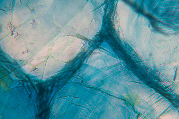 Onion cells at the microscope