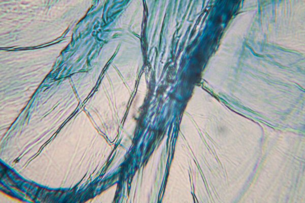 Onion cells at the microscope