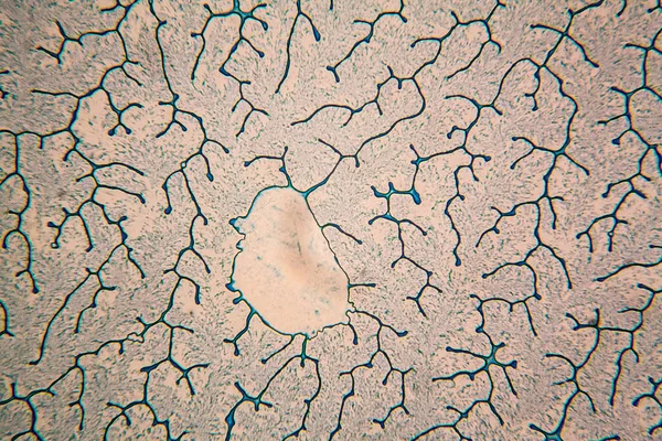 Células Humanas Agua Colorida Seca Microscopio — Foto de Stock