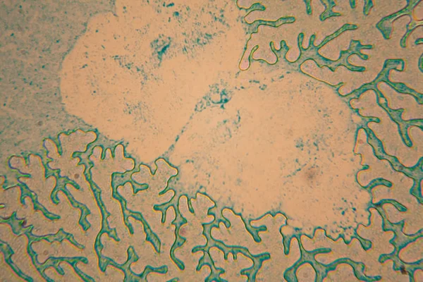 Lidské Buňky Sušených Barevné Vody Mikroskopu — Stock fotografie
