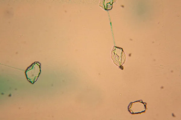 Células Humanas Agua Colorida Seca Microscopio — Foto de Stock