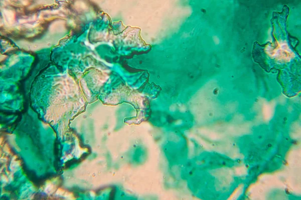 Cellules Humaines Eau Colorée Séchée Microscope — Photo