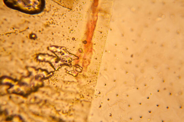 Palomena prasina wing at the microscope