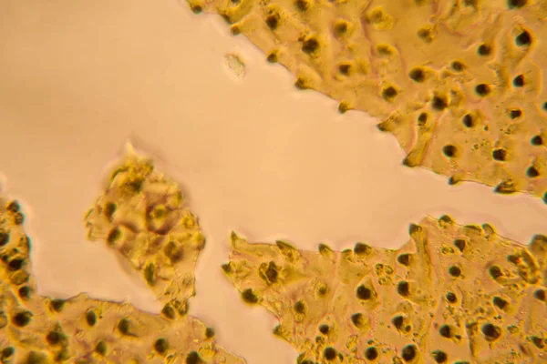 Palomena Asa Prasina Microscópio — Fotografia de Stock