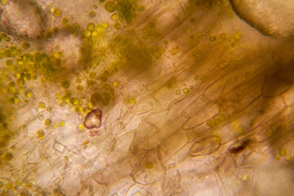 显微镜下腐烂的叶子 — 图库照片
