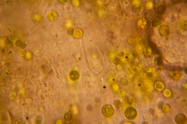 Hojas Podridas Microscopio —  Fotos de Stock