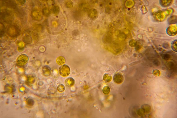 Hojas Podridas Microscopio — Foto de Stock