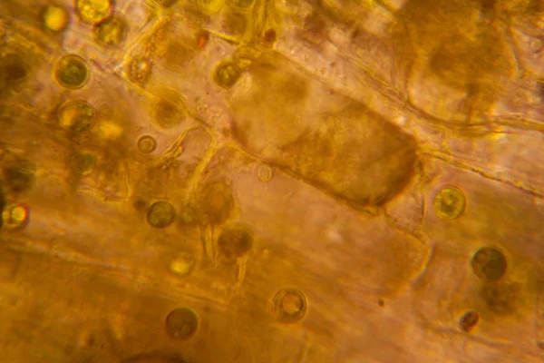 Hojas Podridas Microscopio —  Fotos de Stock