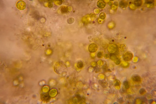 显微镜下腐烂的叶子 — 图库照片