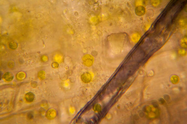 Гнилые листья под микроскопом
