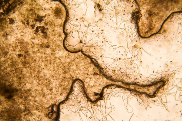 Molde Microscópio — Fotografia de Stock