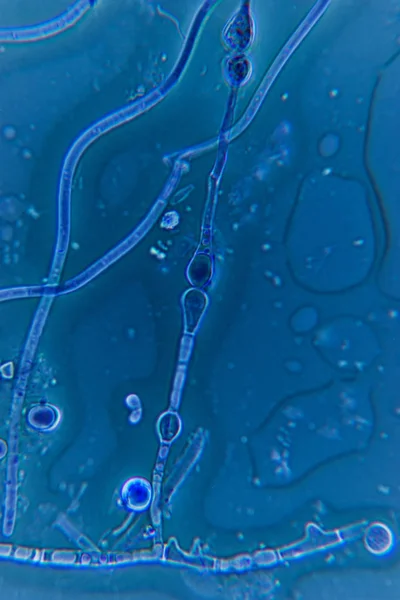 Zgniłych Liści Mikroskopie — Zdjęcie stockowe